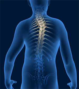 Spine Deformities