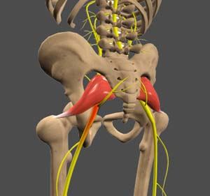  Sciatica  