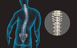  Spine Deformity Surgery 