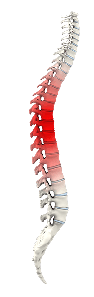  Spine Trauma  