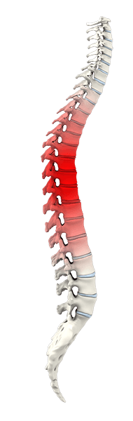 Spine Trauma